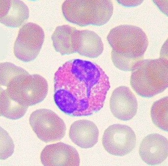 Eosinophiler Granulozyt